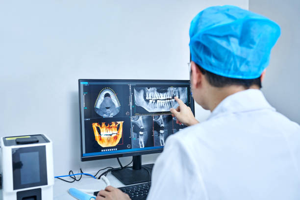 Best Emergency Wisdom Tooth Extraction in Mount Juliet, TN